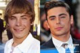 /album/celebrities/zac-efron-plastic-surgery-gallery-600x400-jpg/
