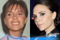/album/celebrities/ent-celeb-surgery-victoria-beckham-600x400-jpg/